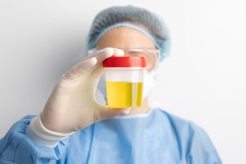 analiza urine, analiza per infeksione urinare