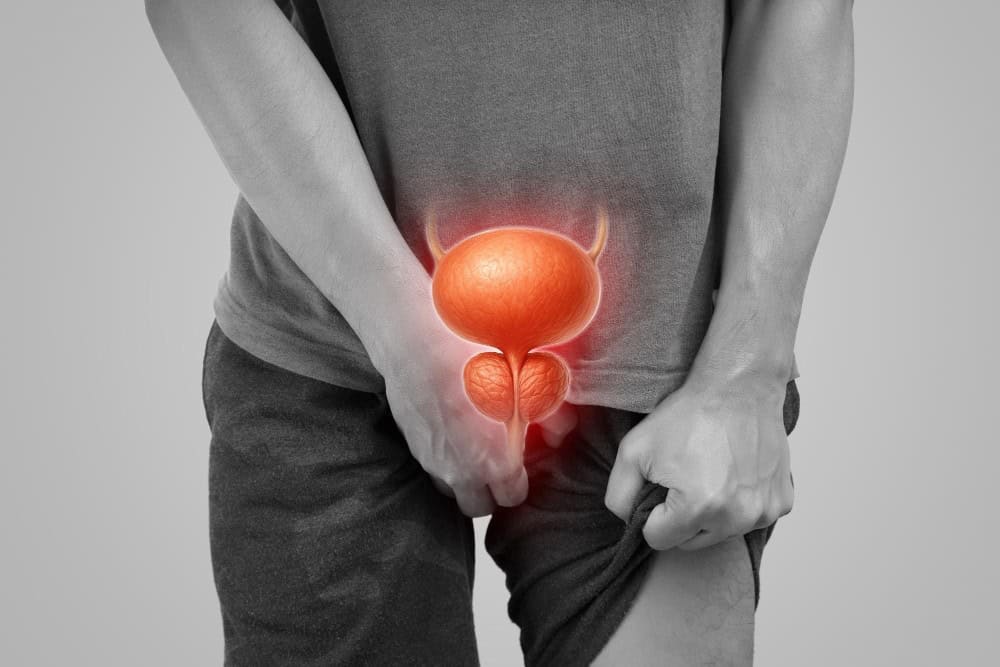 Kur nevojitet kirurgjia e prostatës?