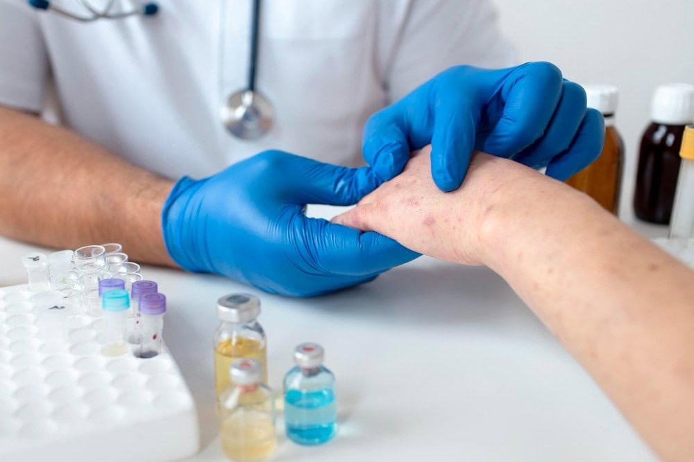 Diagnostikimi i dermatitit