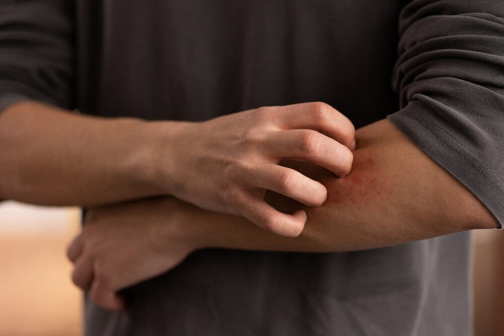 Dermatiti: Shenjat Dalluese dhe Trajtimi
