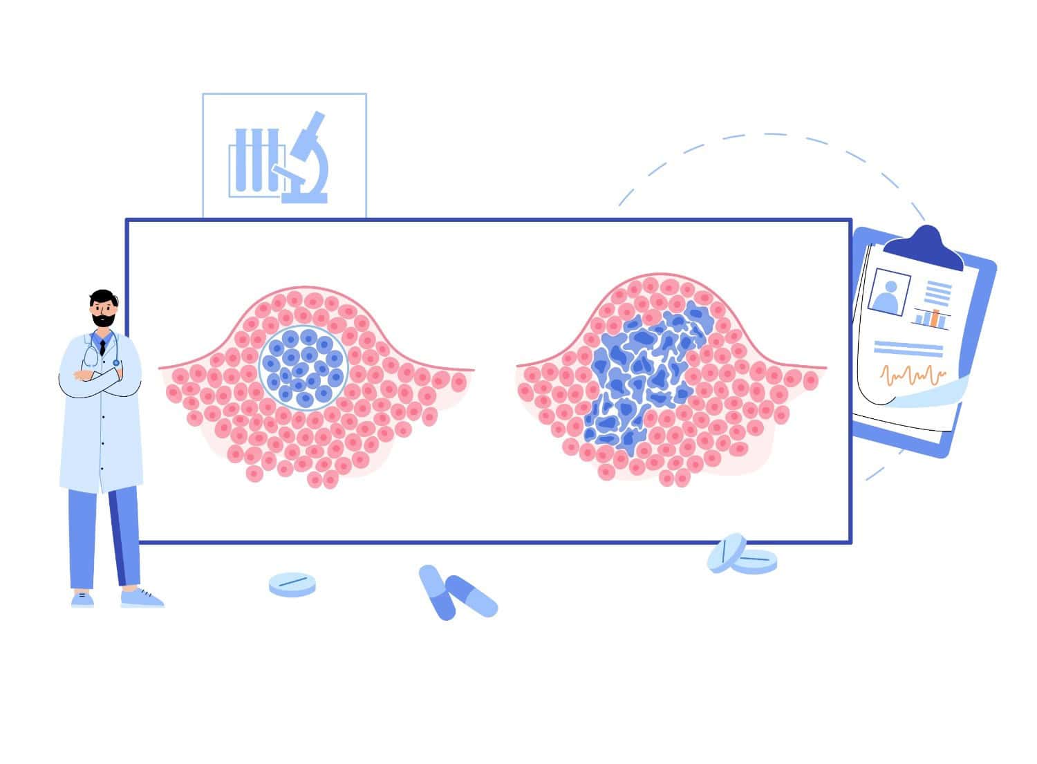 Tumor Markerat – A janë të domosdoshëm në kontrollin vjetor?