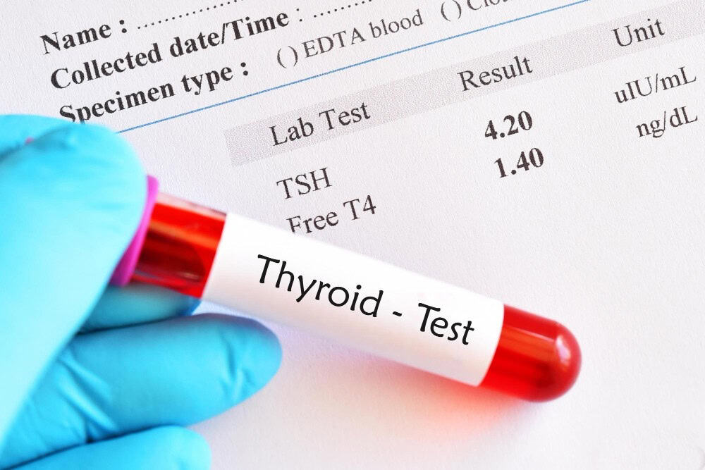 Shenjat e Para të Problemeve Hormonale tek Femrat