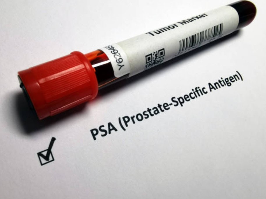 Kontroll mjekësor parandalues me tumor marker për kancerin e prostatës