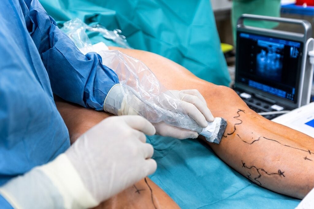 vizita echo doppler ne Tirane
